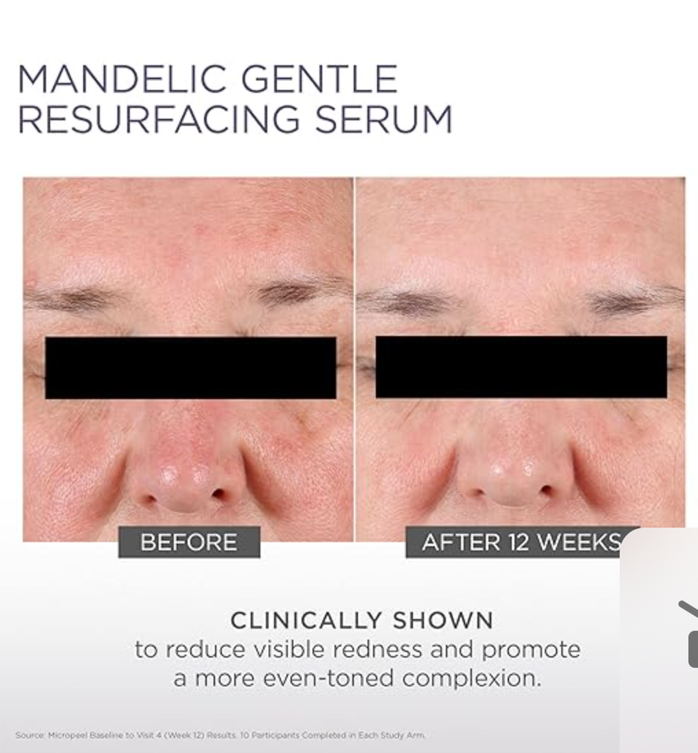 Mandelic Gentle Resurfacing Serum
