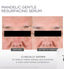 Mandelic Gentle Resurfacing Serum